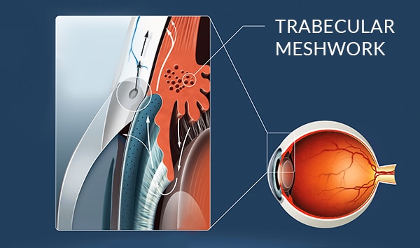 Glaucoma Treatment Farmington Hills | Glaucoma Diagnosis West Bloomfield Township